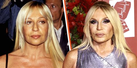 donatella versace prima chirurgia|Donatella Versace cosmetic surgery.